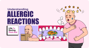 Understanding Allergic Reactions.