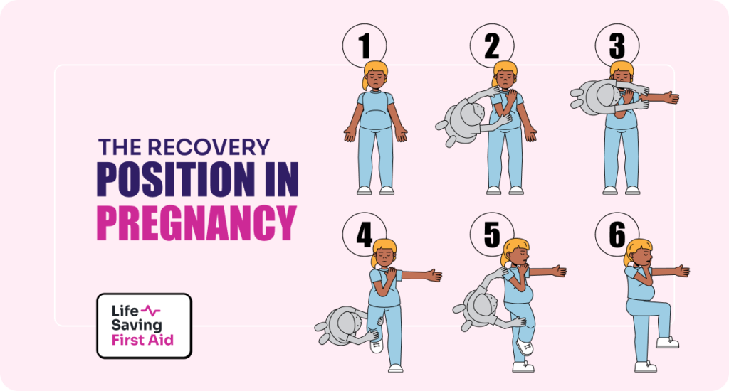 The recovery position in pregnancy